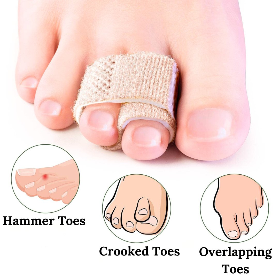 Hammer Crooked Overlapping Toe Corrector