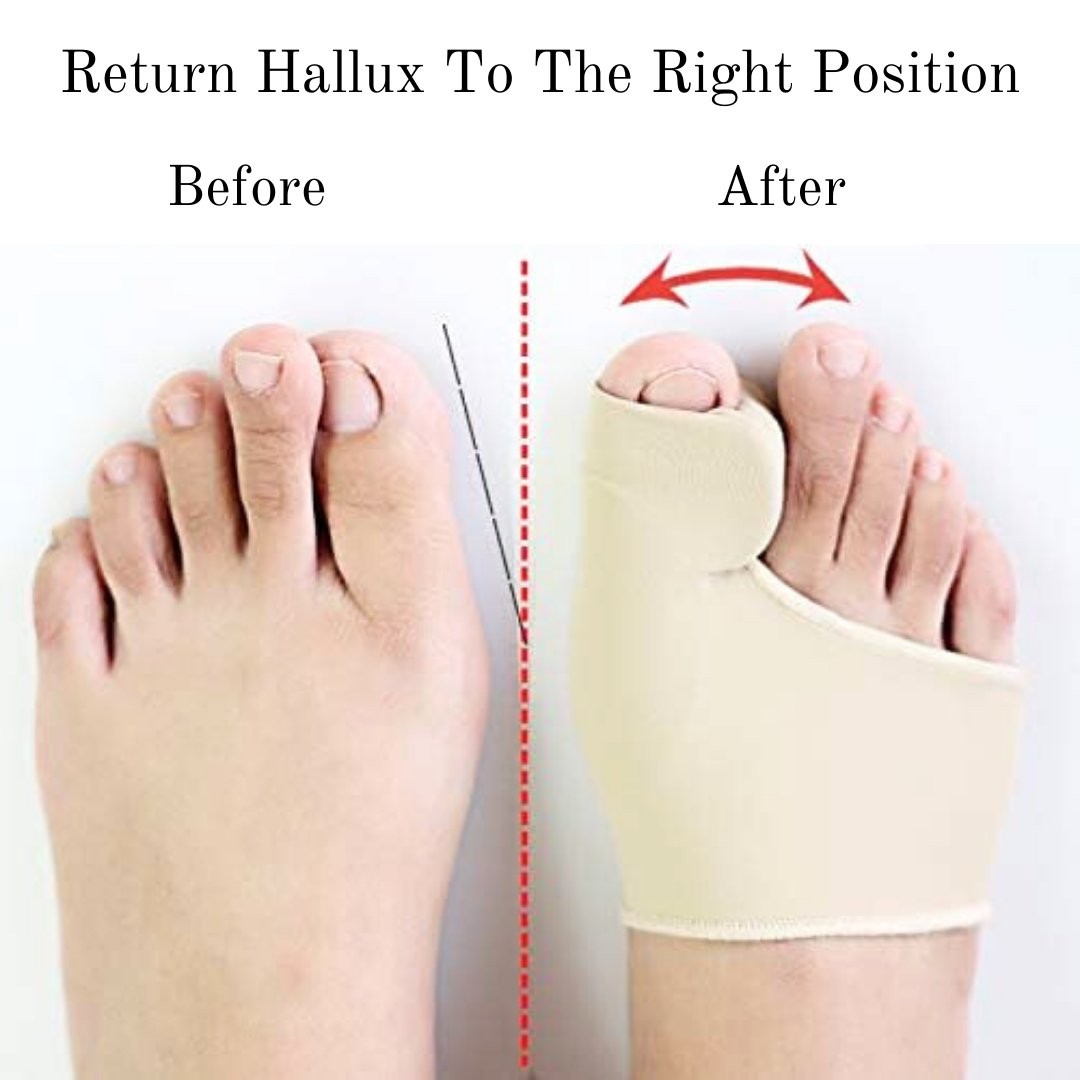 bunion toe splint