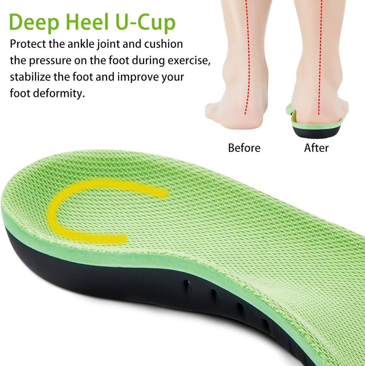 The Sole Care Plantar Fasciitis Insoles |Arch Support Insoles for Men Women| Flat Feet Relief Pain Orthotics Shoe Insole- #Royalkart#orthotic shoe insole