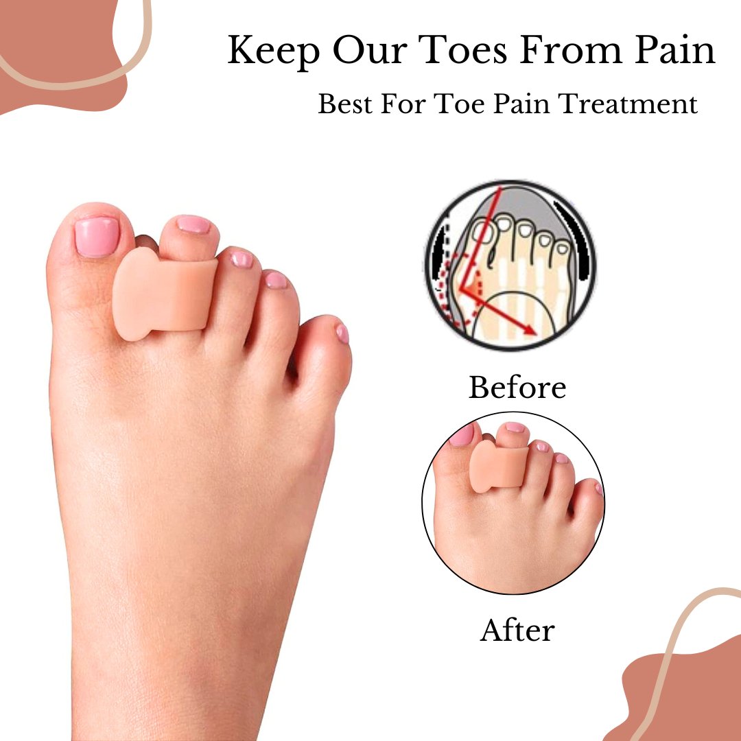 Bunion toe pain relief