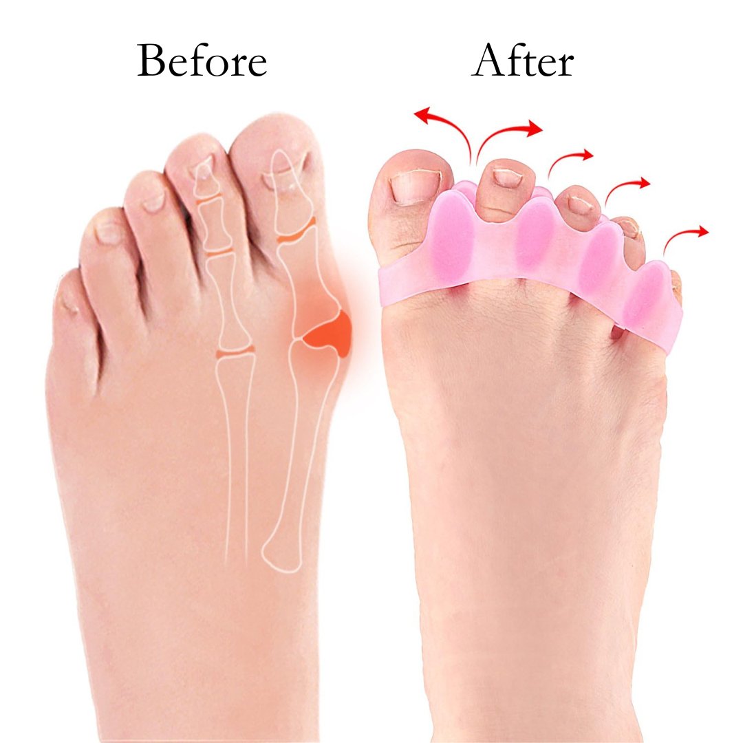 toe seperator