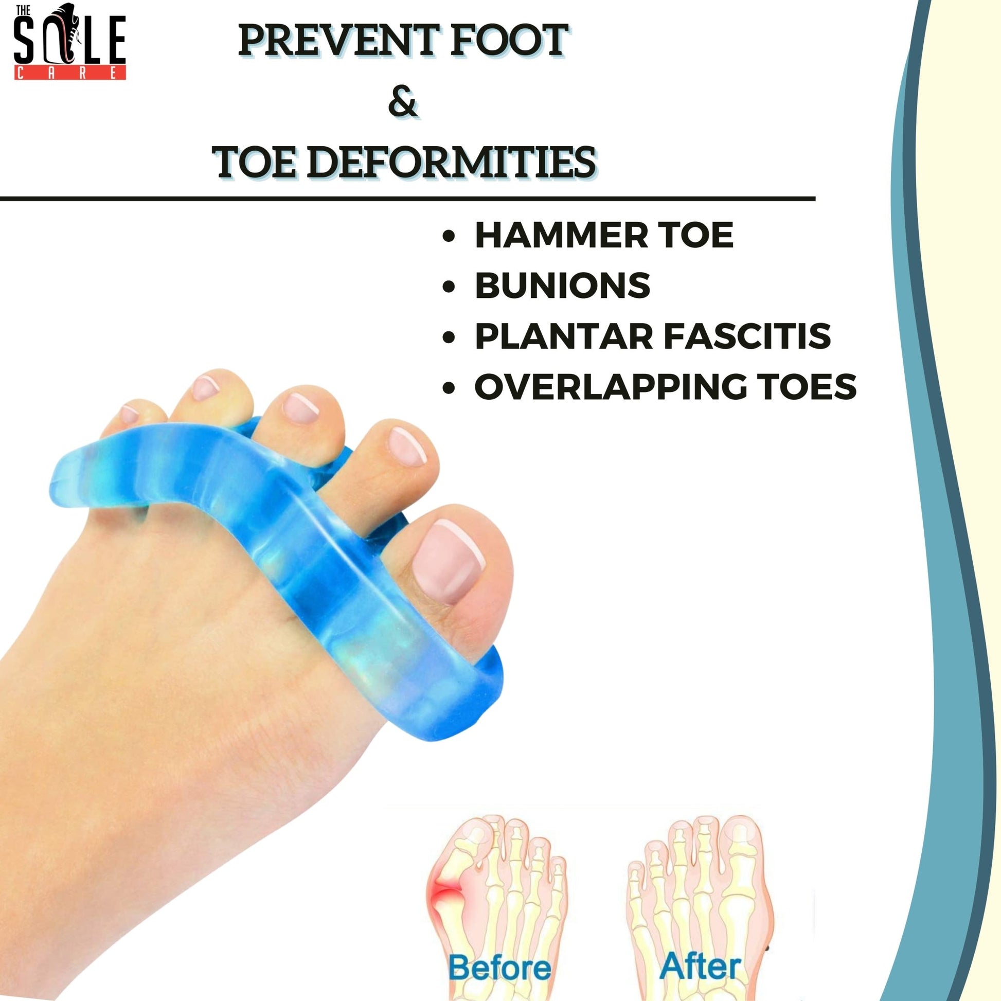 The Sole Care Premium Toe Stretchers For Overlapping Toes/Bunions/Plantar Fascitis/Hammer Toes|Toe Stretchers & Loop Dividers For Unisex | Toe Spacers- Royalkart - The Urban Store
