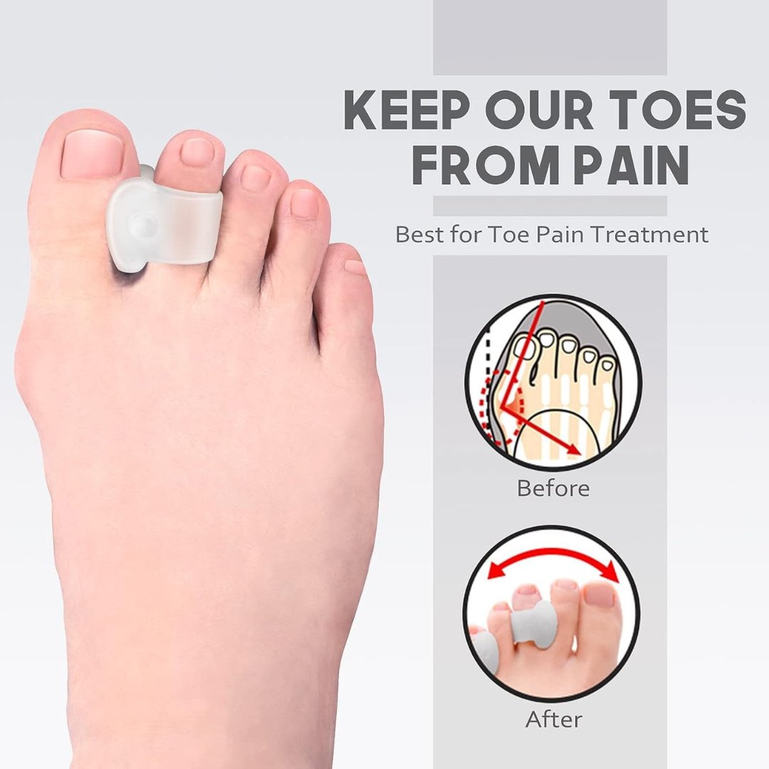 Toe Separators Hammer Toe Straightener| Bunion Corrector Relief (Pack Of 4)(White) Foot Supports- Royalkart - The Urban Store
